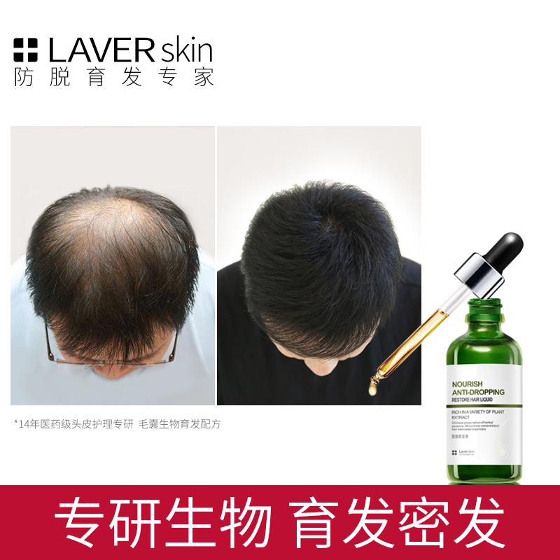 LAVER防脱育发液头发增长液快速生新发脂溢性脱发密发增发营养液