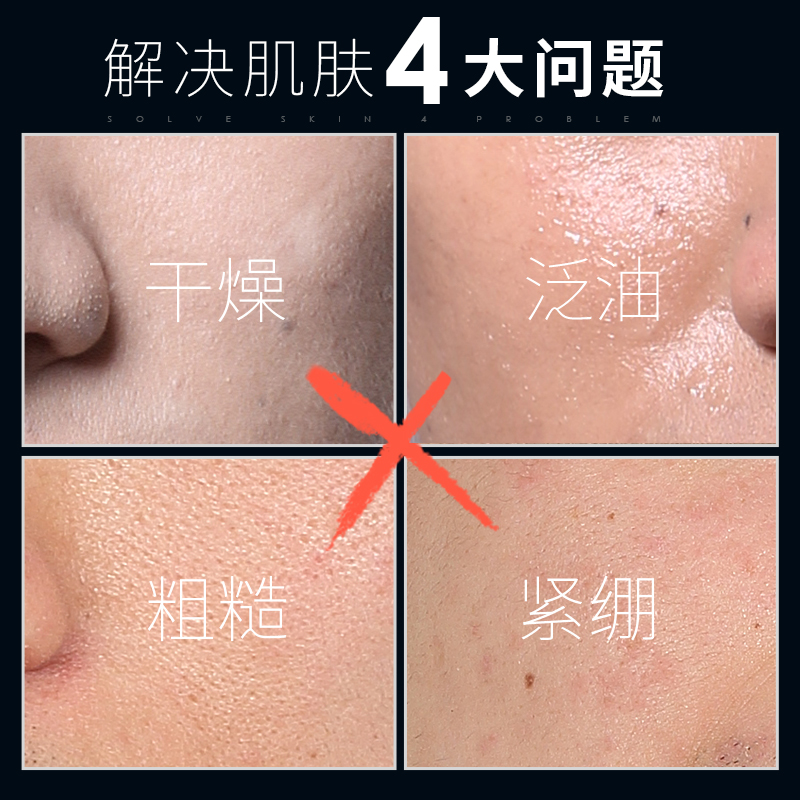 男士爽肤水补水保湿控油收缩毛孔滋润紧肤喷雾护肤化妆品须后水